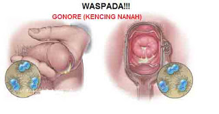 Illustration for article titled Penyebab Kelamin Masih Sakit Setelah Obat Antibiotik Dokter Habis